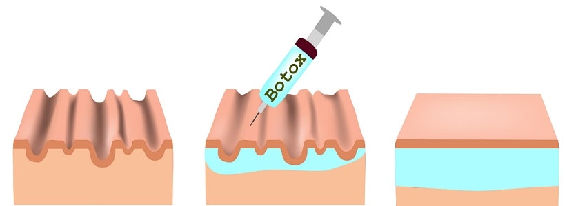 botox-vector
