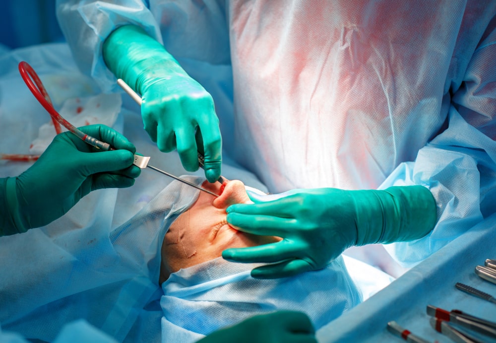 πλαστική στη μύτη από πλαστικό χειρουργό διαδικασία
